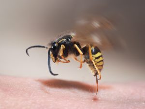 Wasp sting pulls out of human skin.